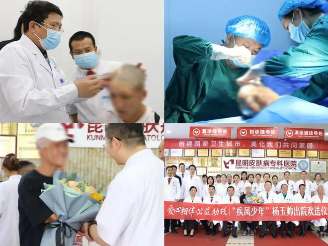 熊猫体育上海九院周国瑜、疤痕名医蔡景龙、黄金井云南义诊！胎记疤痕专项基金在昆启动(图5)