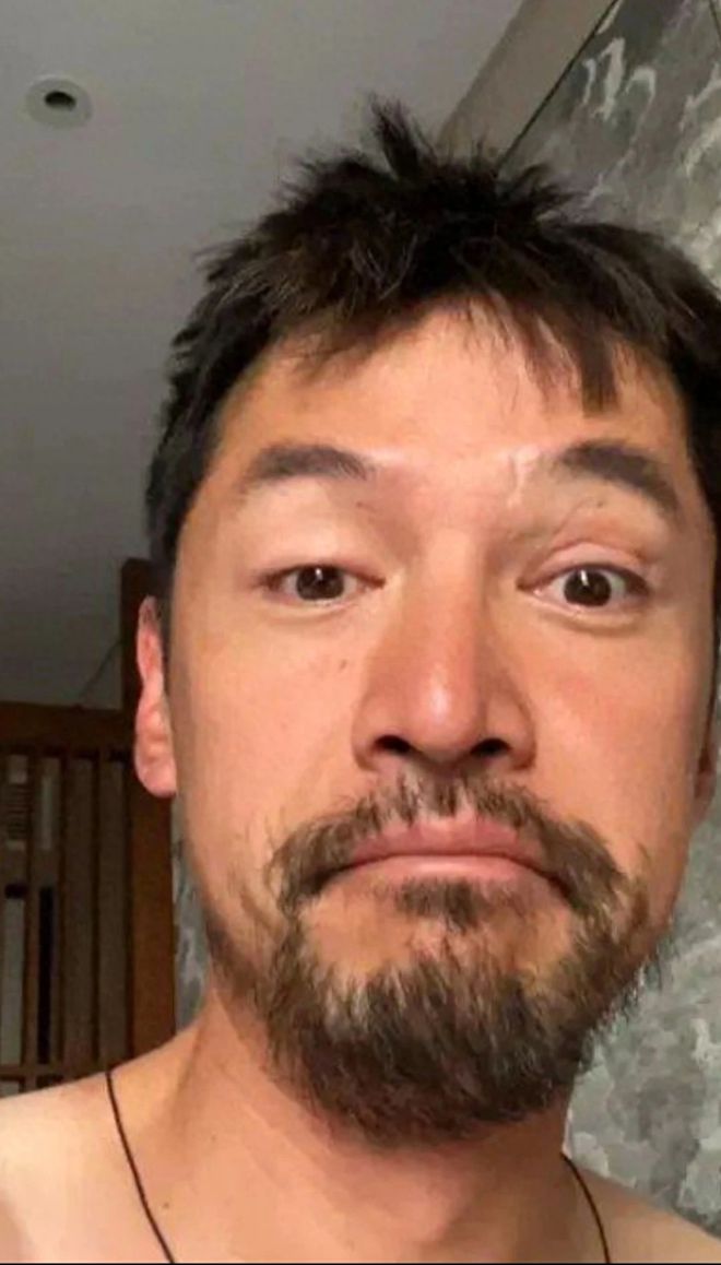 熊猫体育著名演员胡歌被确诊为早F晚E病情引得网友关注粉丝痛心不已！(图3)